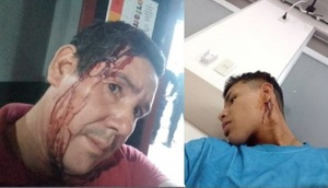 Diario HOY | Batalla campal: distribuidores de droga atacaron a una familia en Encarnación
