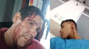 BATALLA CAMPAL: DISTRIBUIDORES DE DROGA ATACARON A UNA FAMILIA EN ENCARNACIÓN