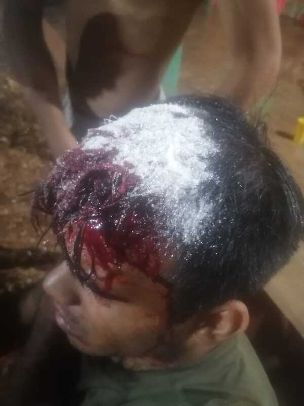 Encuentro de fútbol femenino en Itangua termina con varios heridos con machete