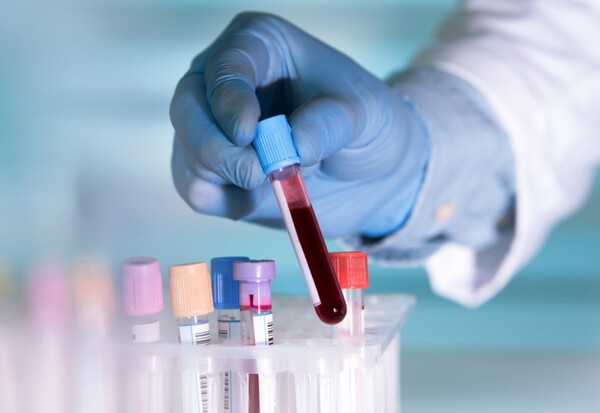 Médicos abogan por la concientización acerca de los tipos de cáncer de la sangre