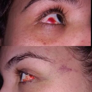 Intento de feminicidio: víctima teme que se libere a quien la amenazó de muerte - Policiales - ABC Color
