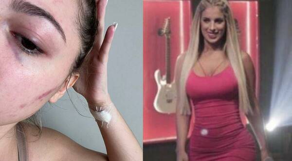 Tati Giménez fue denunciada por arañar a la novia de su ex