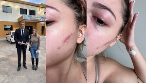 Acusan una vez más a la ex modelo Tati Giménez de agredir a una joven a golpes de puño y arañazos - Teleshow