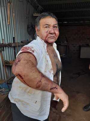 Diario HOY | Violento robo a un sexagenario en Encarnación