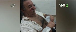 Ataque de terror: Sexagenario brutalmente golpeado - SNT