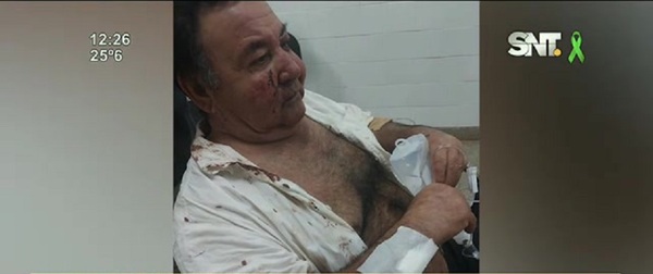 Ataque de terror: Sexagenario brutalmente golpeado - SNT