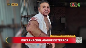 Ataque de terror: Sexagenario brutalmente golpeado - C9N