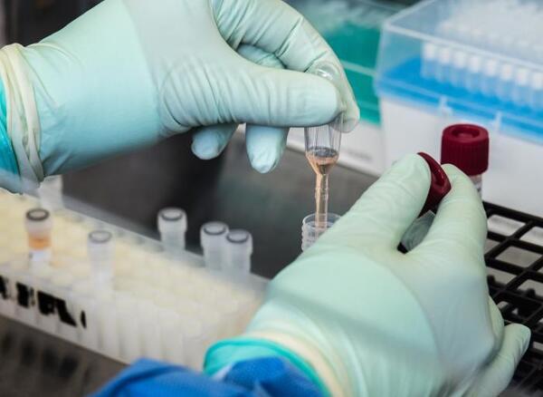 Autoridades sanitarias desmienten existencia de variante XBB del COVID-19