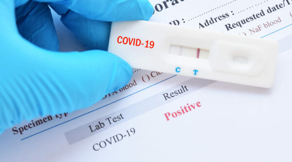 NO REPORTAN NUEVOS FALLECIDOS POR COVID-19