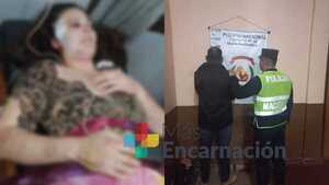 A puños, patadas y mordeduras, mujer sup. fue agredida por su concubino en Pirapey 41