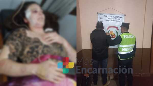 A puños, patadas y mordeduras, mujer sup. fue agredida por su concubino en Pirapey 41