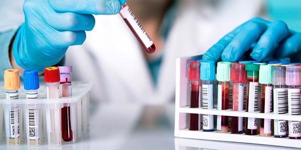 Innovadora prueba de sangre podría detectar más de 50 tipos de cáncer