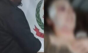 Chofer mordió, pateó y reventó a su doña hasta desfigurarla