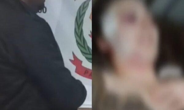 Chofer mordió, pateó y reventó a su doña hasta desfigurarla