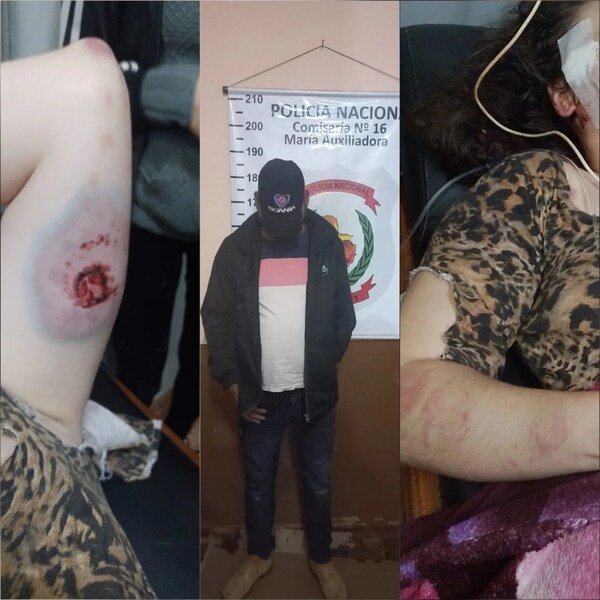 UN HOMBRE AGREDIÓ BRUTALMENTE A SU PAREJA EN PIRAPEY
