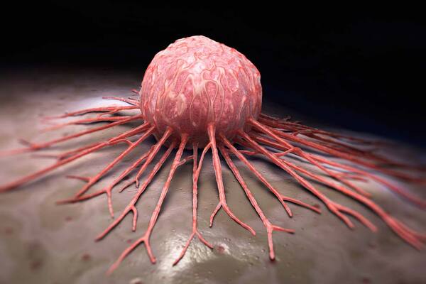 Diario HOY | Un nuevo tratamiento reduce 74% avance de un raro cáncer de sangre