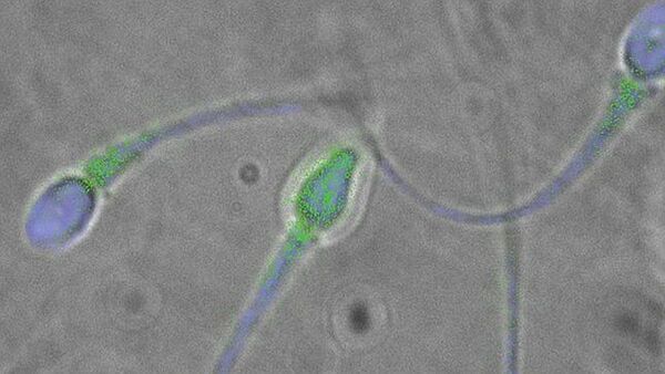 Contaminación ambiental reduce la calidad de los espermatozoides