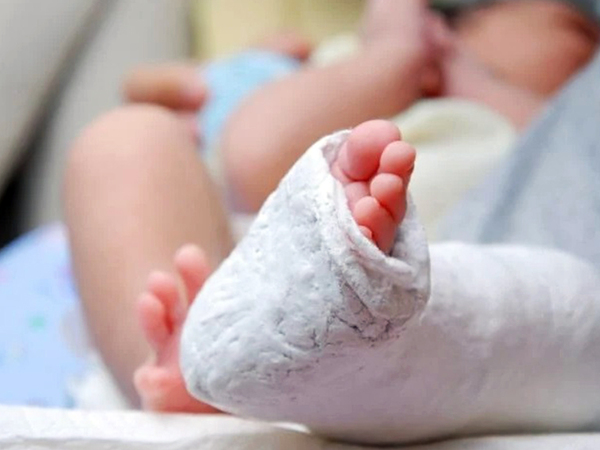 Pie Bot es otro frente de lucha en Salud Pública | Radio Regional 660 AM