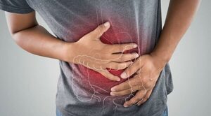 Cáncer de colon: tercero en la causa de muerte en el país