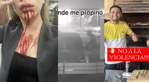La golpeó brutalmente y la persigue hace años: joven denuncia a su expareja - Noticiero Paraguay