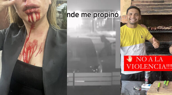 La golpeó brutalmente y la persigue hace años: joven denuncia a su expareja - Noticiero Paraguay