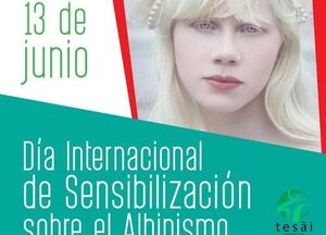 Día Mundial de Sensibilización sobre el Albinismo