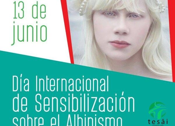 Día Mundial de Sensibilización sobre el Albinismo