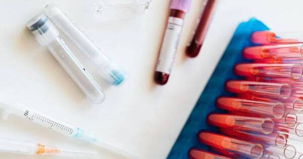 La Nación / ¿Se puede o no tomar agua antes del análisis de sangre?