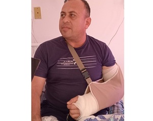 Mecánico de 43 años salva la mano mediante trasplante de huesos y tejidos del gracias a Equipo de la FCM-UNA