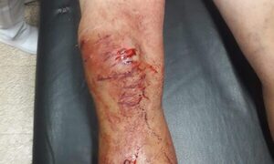 Sujeto hirió con machetillo a su vecino