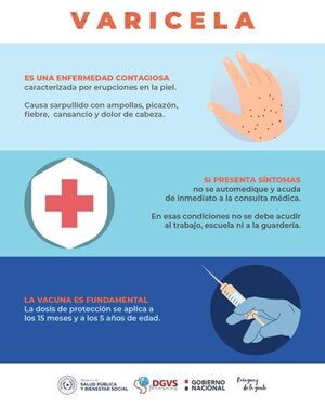 Salud advierte sobre brote de varicela - ADN Digital
