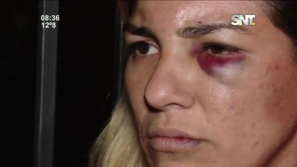 Un militar casi mató a golpes a su pareja - SNT