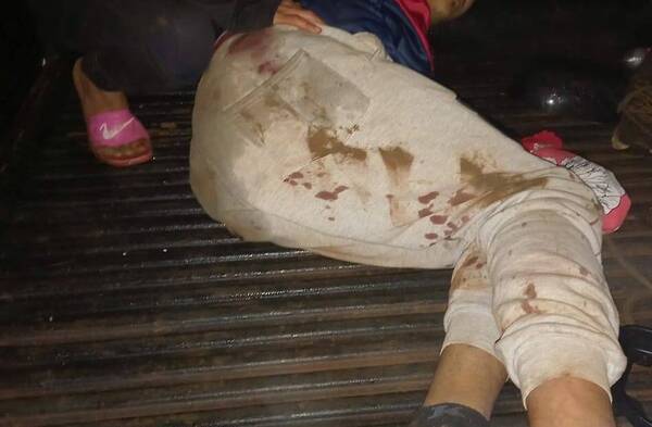 “De onda” ndajeko se comenzaron a “pulsar” por él: ligó dos balazos pero sobrevivió