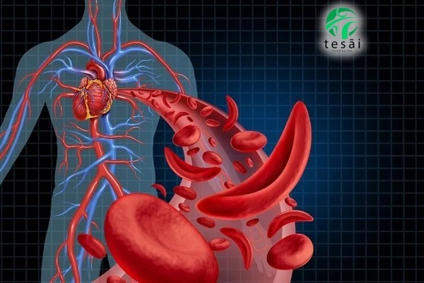 Recuerdan el día Mundial de la Anemia Falciforme