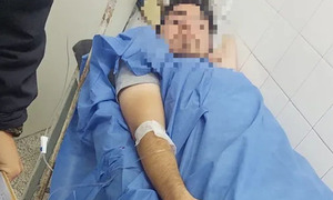 J. Augusto Saldívar: Joven fue disparado en los genitales tras un supuesto roce con motociclistas - OviedoPress