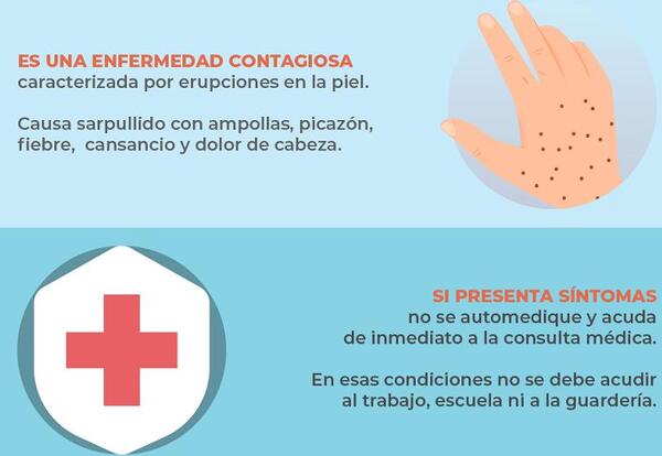 Vigilancia confirma brotes de varicela | Lambaré Informativo
