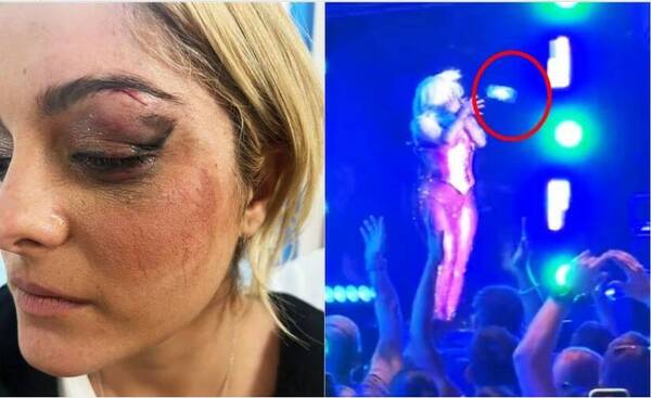 [VIDEO] Cantante quedó noqueada en pleno escenario por un lelu