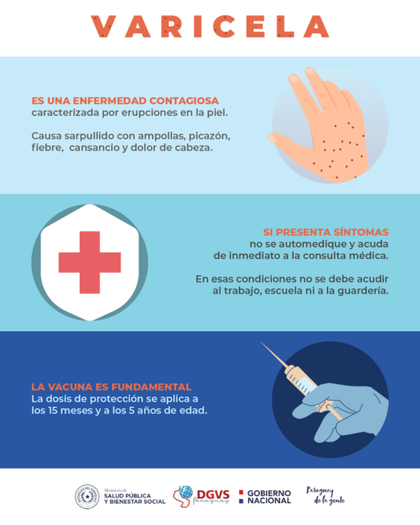 Vigilancia de la Salud confirma brotes de varicela, habituales en esta época del año