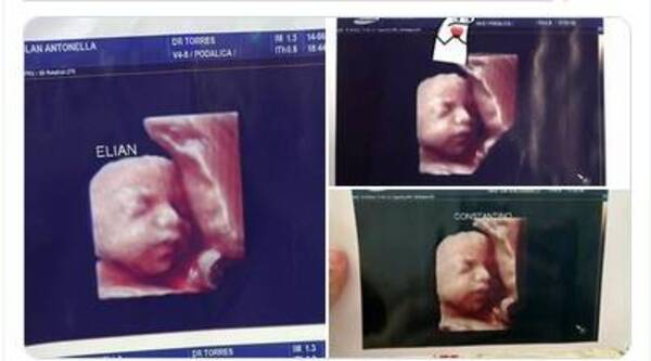 Estafa a embarazadas: Daban foto de la misma ecografía a todas las mamis