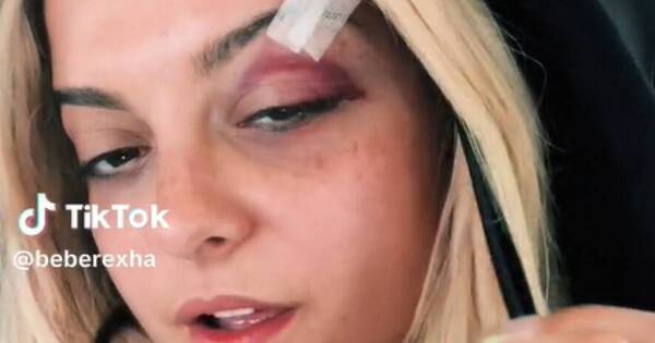 La Nación / La cantante Bebe Rexha fue agredida en pleno concierto