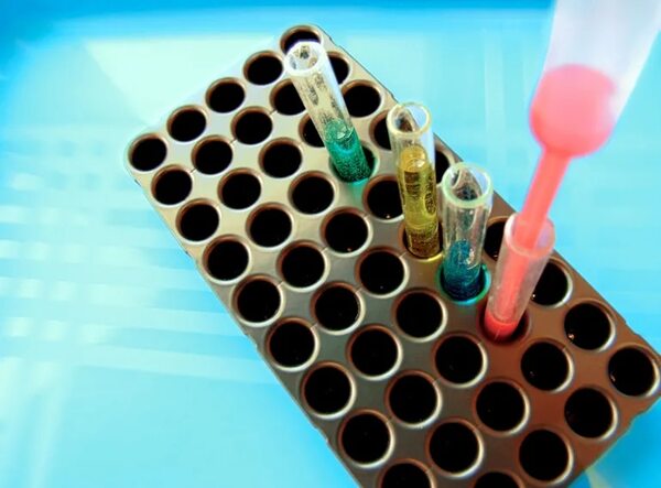 Clave para retrasar el envejecimiento en una investigación de científicos hongkoneses - Ciencia - ABC Color