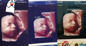 Diario HOY | Grave denuncia en Formosa: usaban la misma ecografía con todas las embarazadas