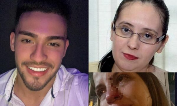 Fiscal habría recibido jugosa coima para no imputar a violento sujeto que desfiguró a su exnovia