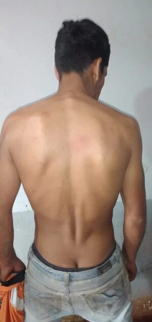 Detenido por violación y robo: maniató a su víctima y la amenazó con pistola de juguete - Policiales - ABC Color