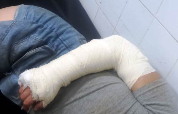 Celoso joven baleó a su novia y huyó •