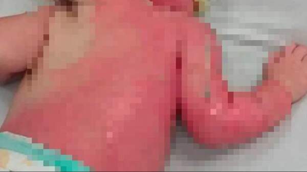 Mamá de bebé de 3 meses tropezó y la tiró al brasero