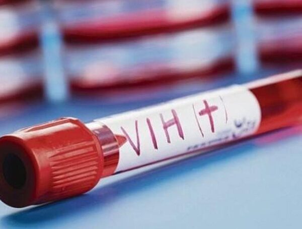 VIH en Paraguay: más de 1.500 nuevos diagnósticos en el 2022 · Radio Monumental 1080 AM