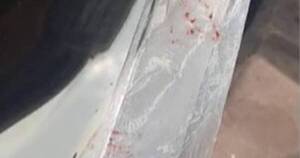 La Nación / Durante intento de asalto, un hombre fue atacado con un machete