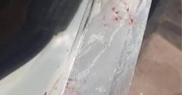 La Nación / Durante intento de asalto, un hombre fue atacado con un machete