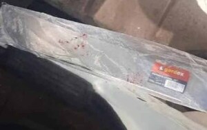 Durante intento de asalto, un hombre fue atacado con un machete en Mariano Roque Alonso – Prensa 5